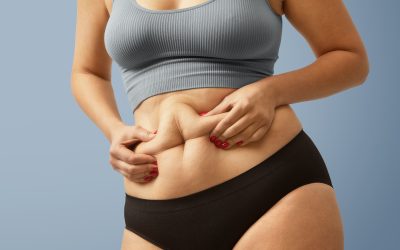 Tummy Tuck in Nairobi Kenya